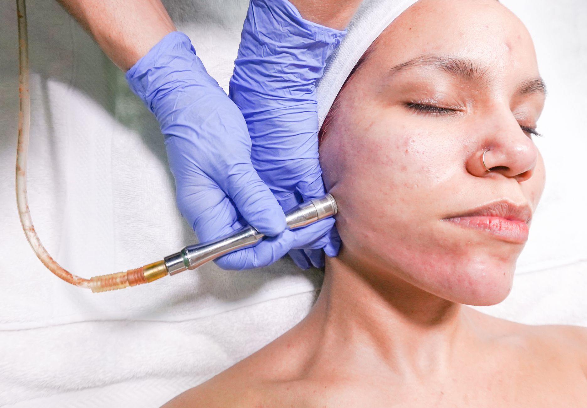 Exfoliation professionnelle lors d'un soin visage en institut de beauté à Montréal